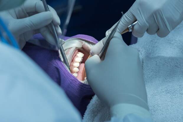 Павел Буковски покончил с собой после удаления всех зубов в турецкой клинике