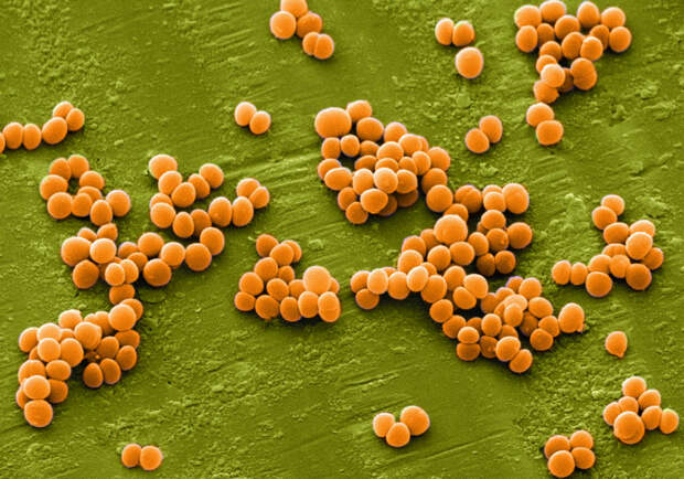 Вот что нужно знать о золотистом стафилококке: домашние средства способные побороть инфекцию.