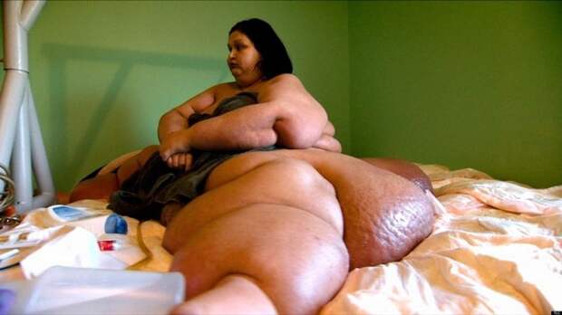 Вес женщины составлял 499 кг вес, женщина, изменение, история, мир, похудение, фото