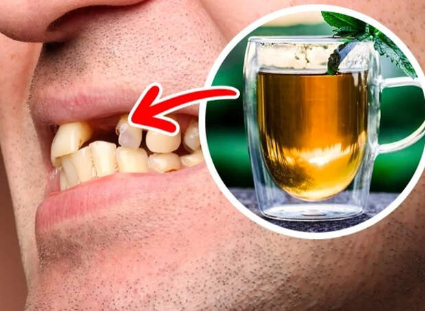 9 продуктов, от которых портятся зубы