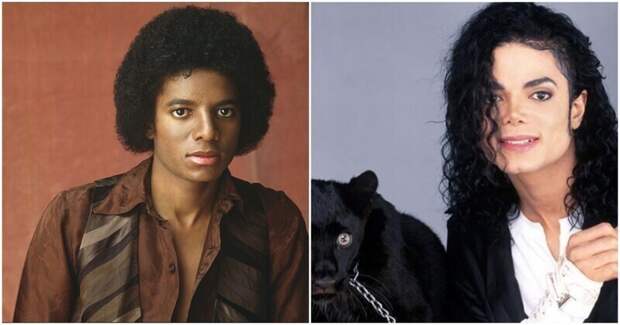 Медики пояснили, отчего так резко поменялась внешность Майкла Джексона
