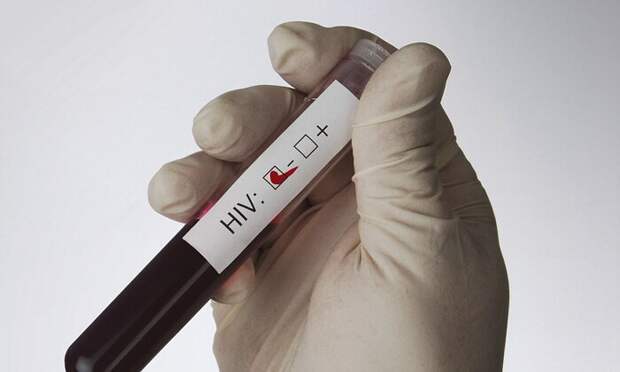 5 июня. Открытие ВИЧ - «чумы XX века»