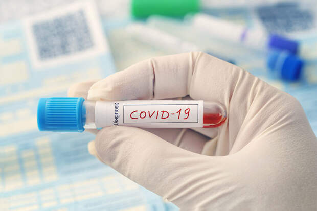 В России за сутки выявили 19179 заражённых COVID-19