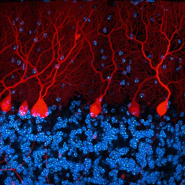 Мозговое вещество трансгенной мыши в 3D