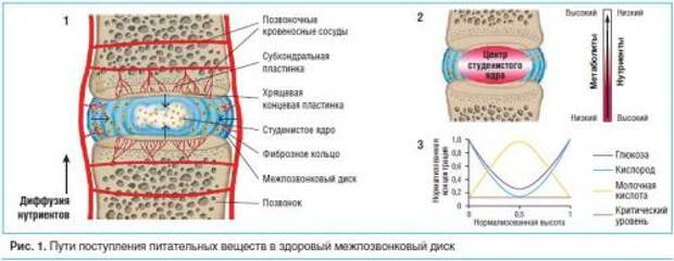 Как восстановить хрящ домашних условиях. Эффективны ли хондропротекторы