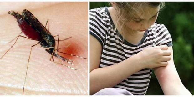 Лечение укусов насекомых народными средствами