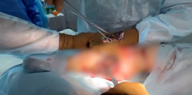 Редкие кадры работы военных хирургов на передовой