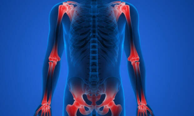 Обследование состояния суставов методом магнитно-резонансной томографии