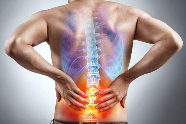 Симптомы грыжи межпозвонкового диска