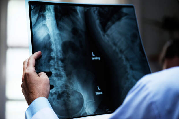 В больницы Подмосковья поставили еще 4 новых рентген-аппарата