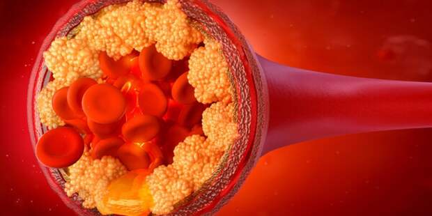 Генетический прорыв: ученые нашли способ отключить «плохой» холестерин
