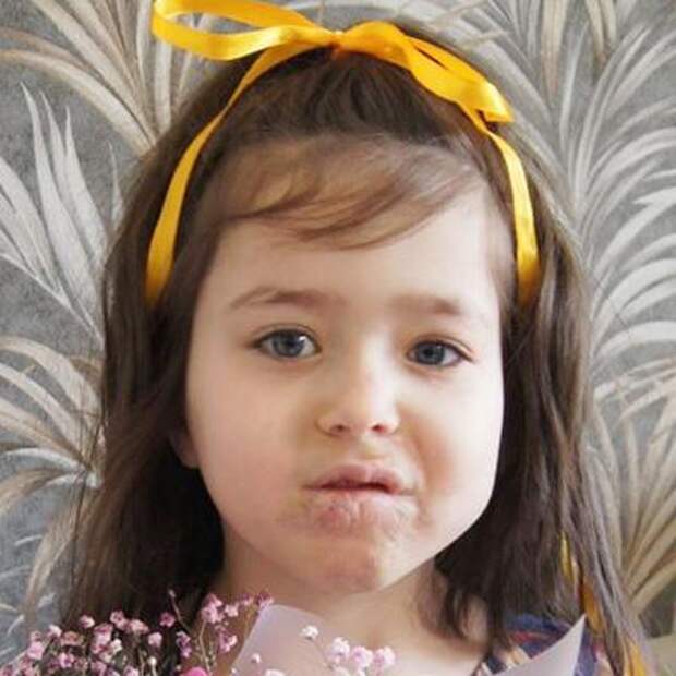 Василина Славинская, 7 лет, гиперплазия кровеносных сосудов лица, требуется комплексное ортодонтическо-хирургическое лечение, 287 238 ₽