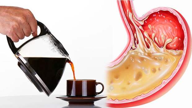 Изжога от кофе: почему возникает и как с ней бороться?