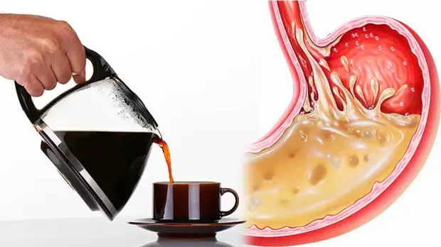Изжога от кофе: почему возникает и как с ней бороться?