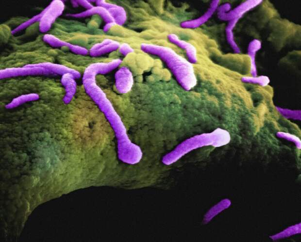 В Муроме зарегистрировано 106 случаев острого кишечного заболевания