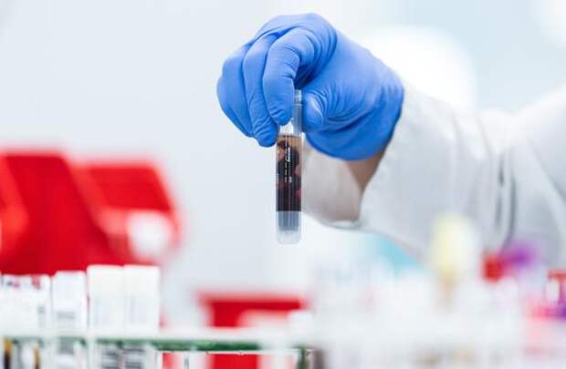 В России за сутки выявили 5 842 зараженных COVID-19