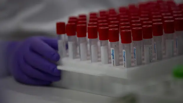 В Псковской области зарегистрировали 237 случаев коронавируса за сутки