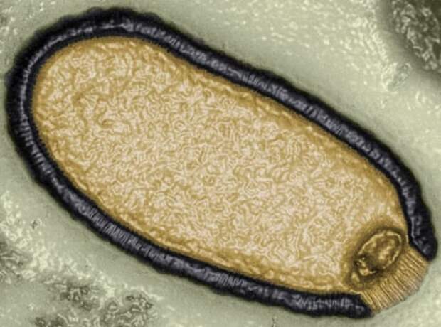Увеличенное компьютером изображение сибирского питовируса