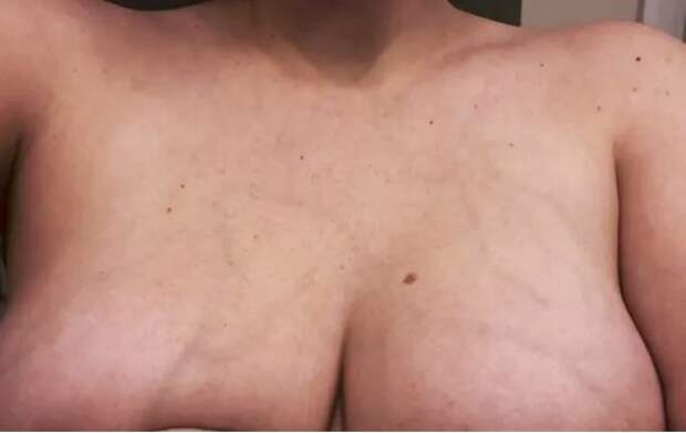 26 правдивых фотографий, которые показывают, что такое беременность на самом деле