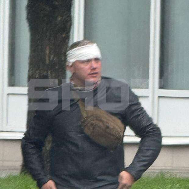 Мужу Елены Блиновской проломили голову в центре Москвы – подробности