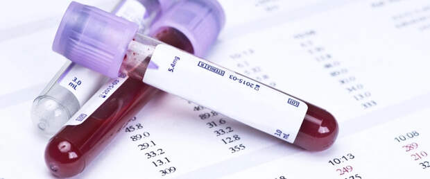 ИИ выявляет 15 типов рака по базовым анализам крови