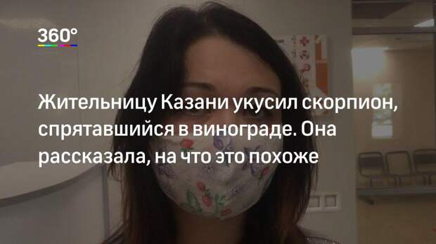 Жительницу Казани укусил скорпион, спрятавшийся в винограде. Она рассказала, на что это похоже