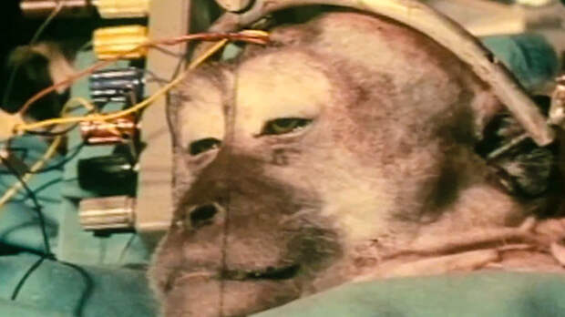 Шок: российского пациента готовят к первой в мире пересадке головы! операция, пересадка головы, трансплантация, чудеса науки