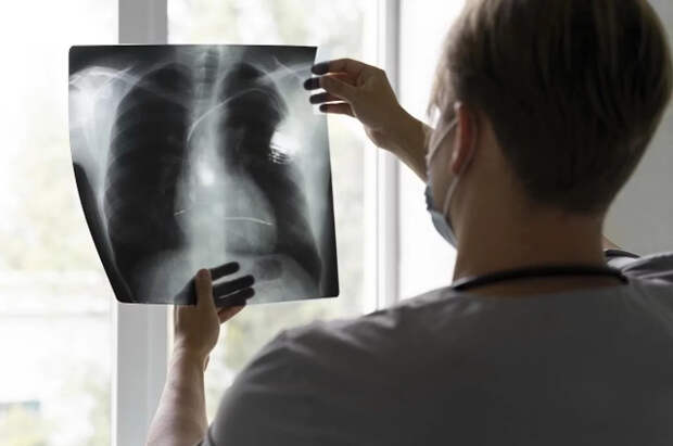 Случай туберкулеза выявили в школе Приморского района Петербурга