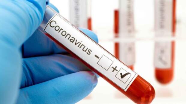 пробирка с кровью на коронавирус