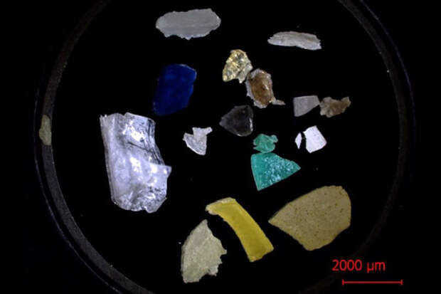 npj Parkinson: микропластик может быть связан с развитием болезни Паркинсона