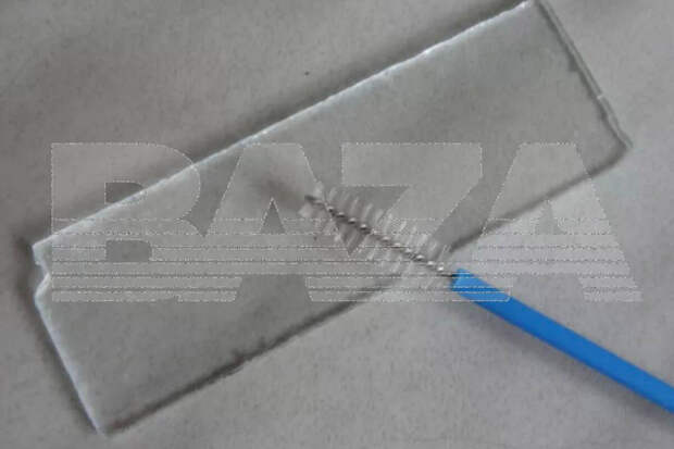 Baza: гинеколог оставила пациентку с болями, забыв внутри инструмент