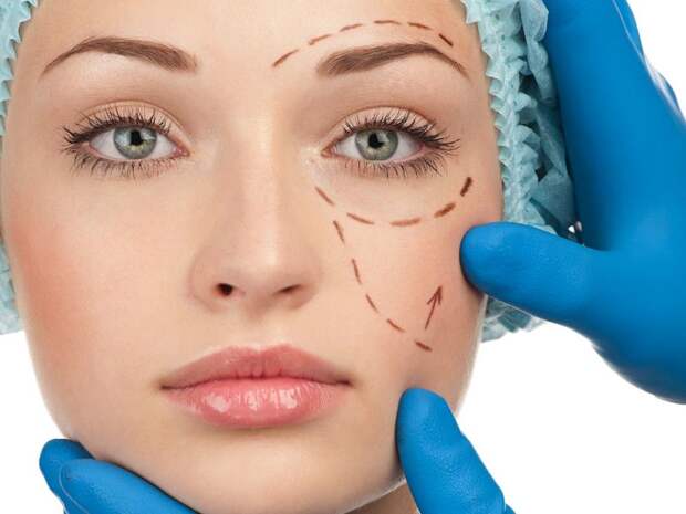 Plasticsurgery07 7 самых безрассудных людей, страдающих манией пластических операций