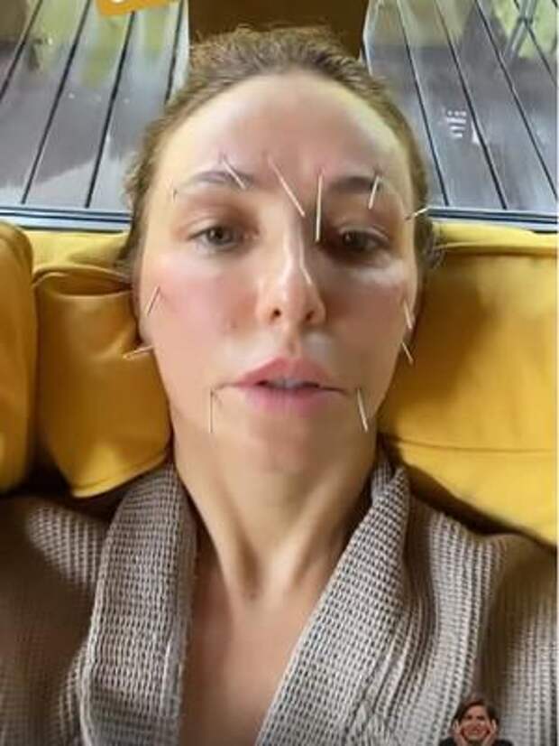Даже выглядит больно! Татьяна Навка показала жуткую бьюти-процедуру