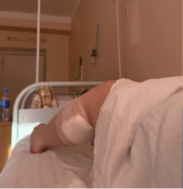 СК начал проверку из-за ожога пациентки во время операции