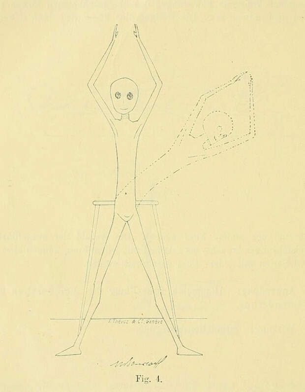 lechebnaya-gimnastika-v-ginekologii-po-Ture-Brandtu-illyustratsii 2