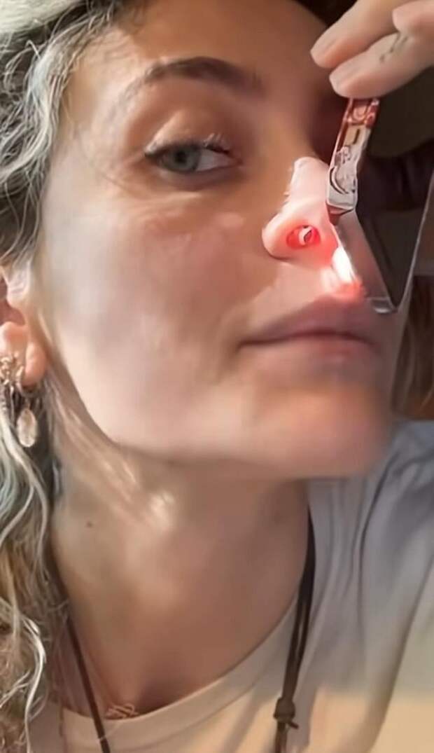 «Это разрушило мою жизнь»: Пэрис Джексон рассказала, что у неё образовалась дыра в носу из-за наркотиков