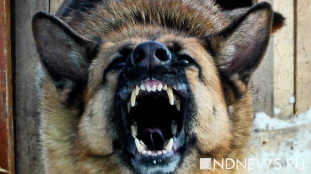 Девочка попала в больницу с тяжелыми травмами после нападения собак