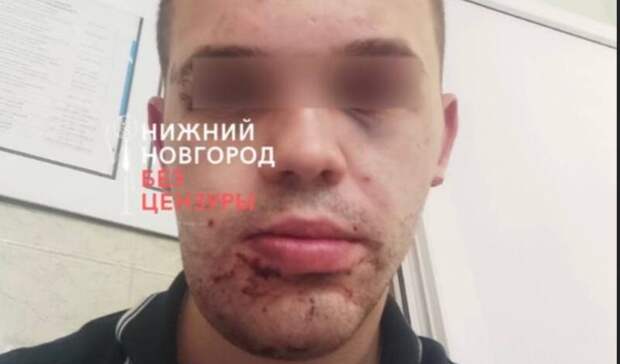 Неизвестные грабят и избивают посетителей Сормовского парка