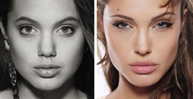 Angelina-Jolie-Plastic-Surgery-Before-and-After-Photo