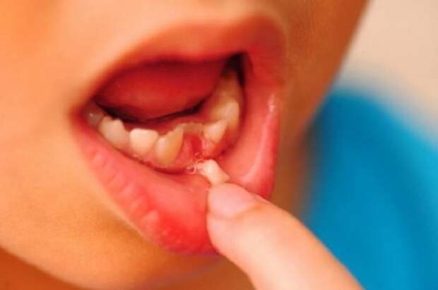 Вот почему нужно сохранять молочные зубы ребенка. Поразительное открытие!