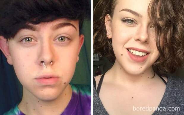 18-Year-Old Male To Female, 1 Year Difference