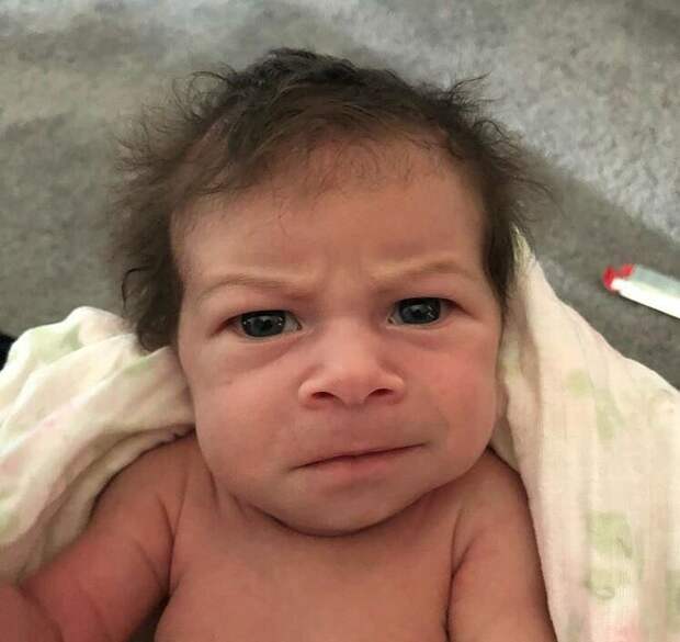Когда ребенок рождается с волосами на лице