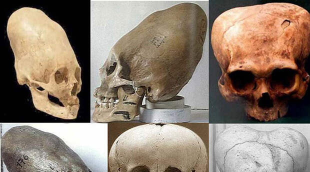 Удлиненные черепа При раскопках в регионе Лапаил археологи обнаружили удлиненные черепа. Открытие взбудоражило весь научный мир: необычная форма останков это еще цветочки, ведь ученые считали, что человек никогда не был в Антарктиде прежде.