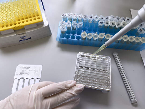 Раскрыты подробности о новом случае оспы обезьян в России