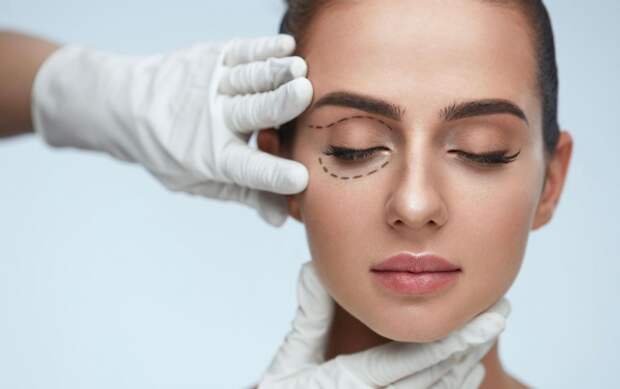 Как блефаропластика стирает годы с лица: примеры работ до и после Как блефаропластика стирает годы с лица: примеры работ до и после