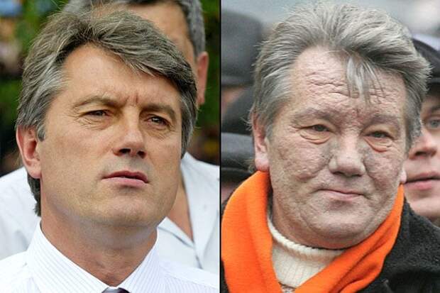 Виктор Ющенко, бывший президент Украины, до и после отравления диоксином загадки, интересно, неизведанное, познавательно, тайны