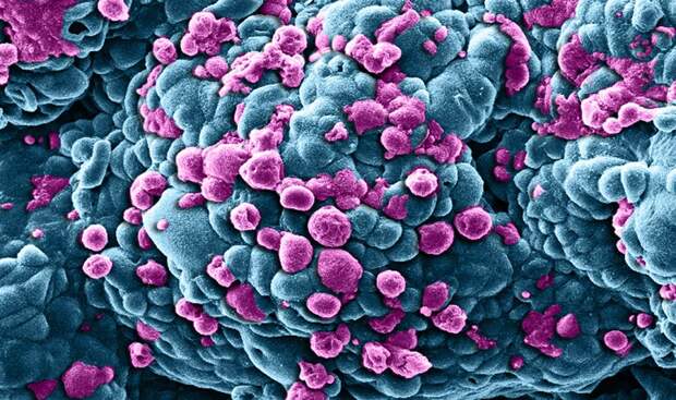 Клетки рака молочной железы под действием лекарственных средств наноразмера