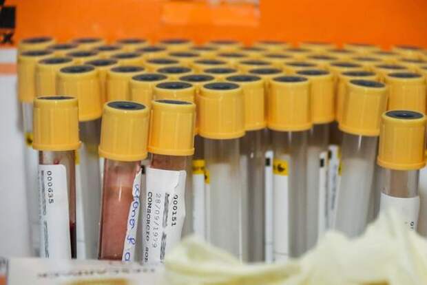 За сутки в России скончались 90 человек с коронавирусом