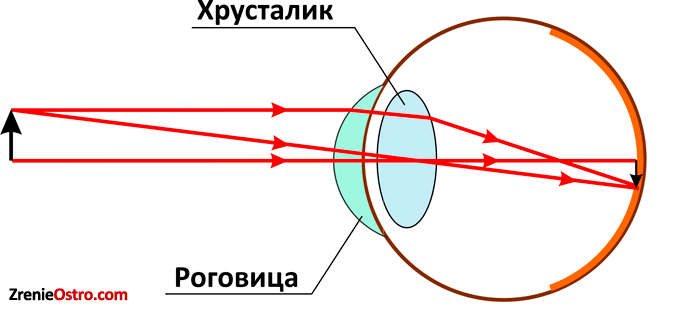 Человек видит перевернутое изображение